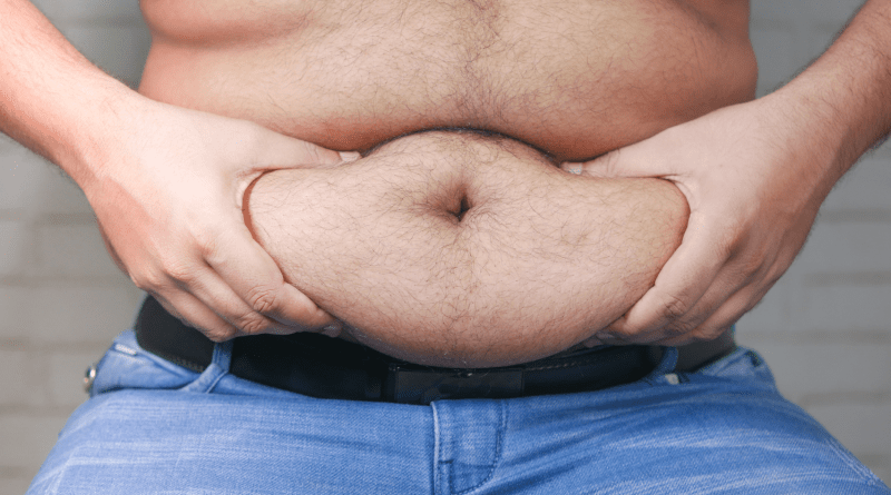 Gastric Sleeve in Istanbul
